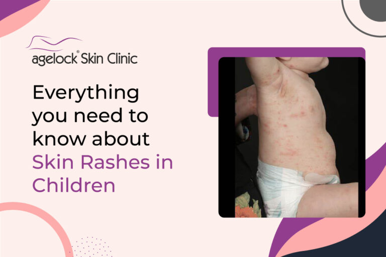 Everything you need to know about skin rashes in children