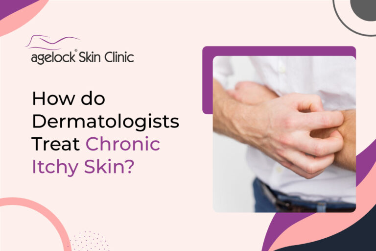 How do dermatologists treat chronic itchy skin?