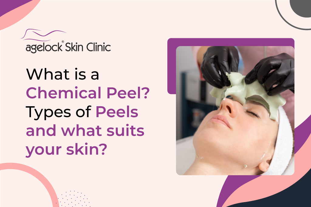 <strong>What is a Chemical Peel? Types of Peels and what suits your skin?</strong>