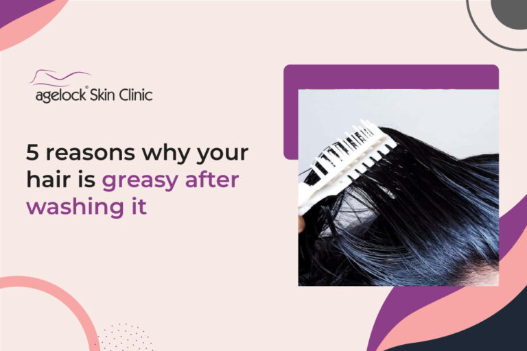 5 Reasons why your hair is greasy after washing it