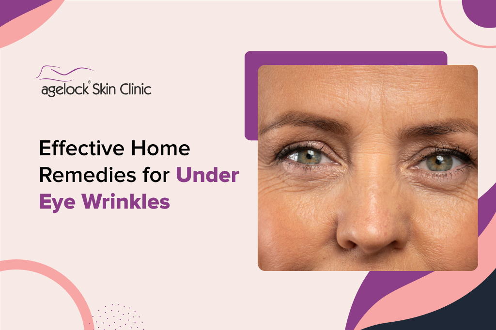 5-effective-home-remedies-for-under-eye-wrinkles-agelock-skin-clinic