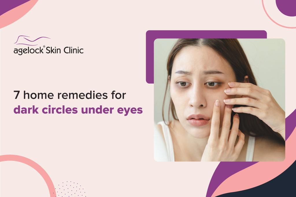 7 home remedies for dark circles under eyes - Agelock Skin Clinic