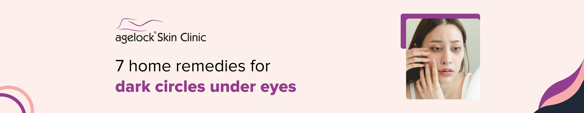 7 home remedies for dark circles under eyes