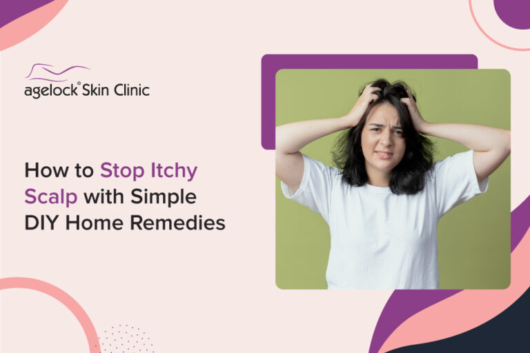 How to Stop Itchy Scalp with Simple DIY Home Remedies