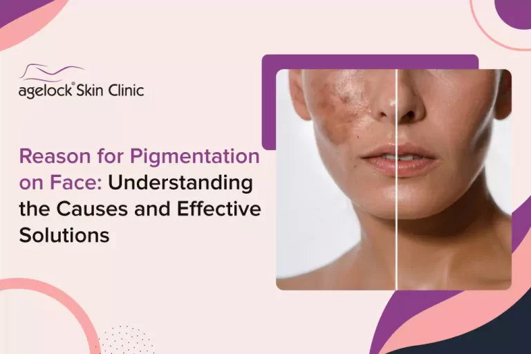 Reason-for -Pigmentation-on -Face -Understanding - the - Causes - and - Effective - Solutions