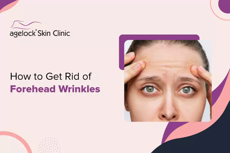 How- to -Get- Rid- of -Forehead -Wrinkles