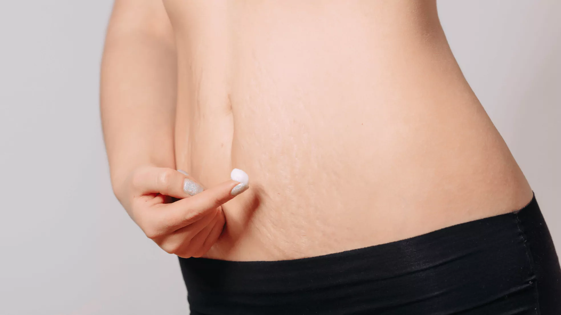 Prp Treatment For Stretch Mark Removal In Chandigarh Prp Treatment For Stretch Mark Removal In Chandigarh