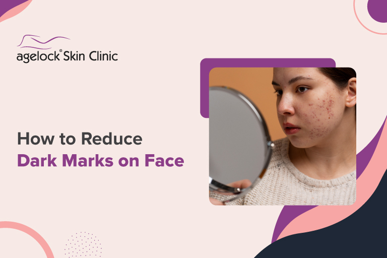 How to Reduce Dark Marks on Face