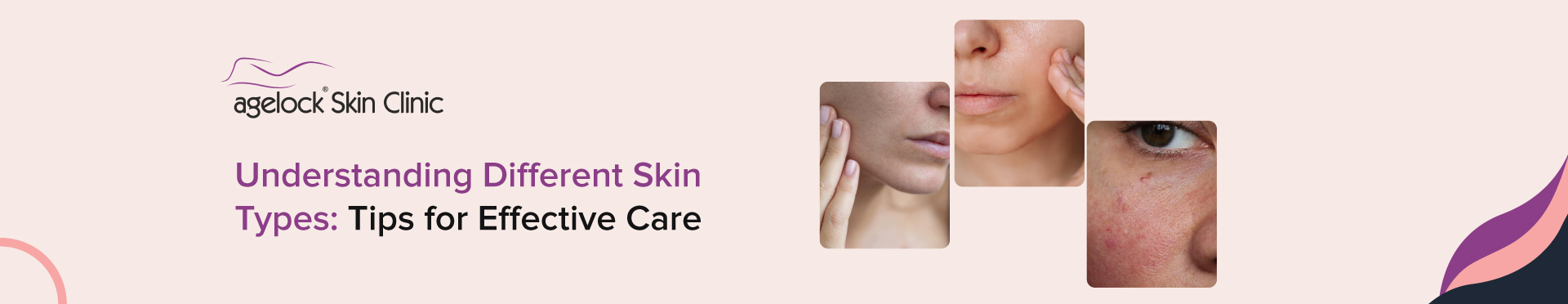 Understanding Different Skin Types: Tips for Effective Care