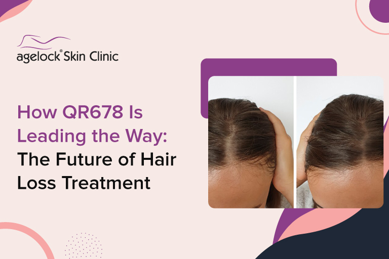 How QR678 Is Leading the Way: The Future of Hair Loss Treatment