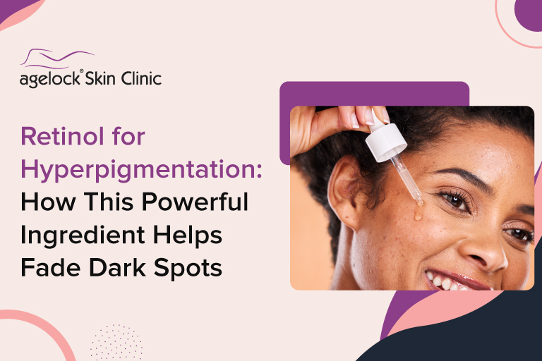 Retinol for Hyperpigmentation: How This Powerful Ingredient Helps Fade Dark Spots