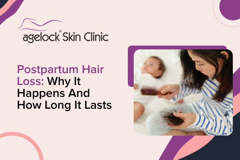 Postpartum Hair Loss: Why It Happens and How Long It Lasts